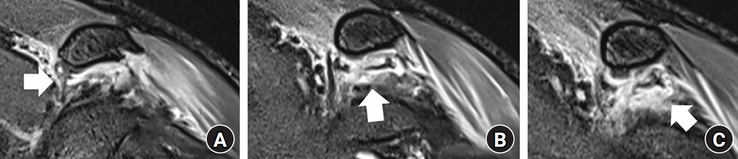 jmt-2026-00241f3.jpg